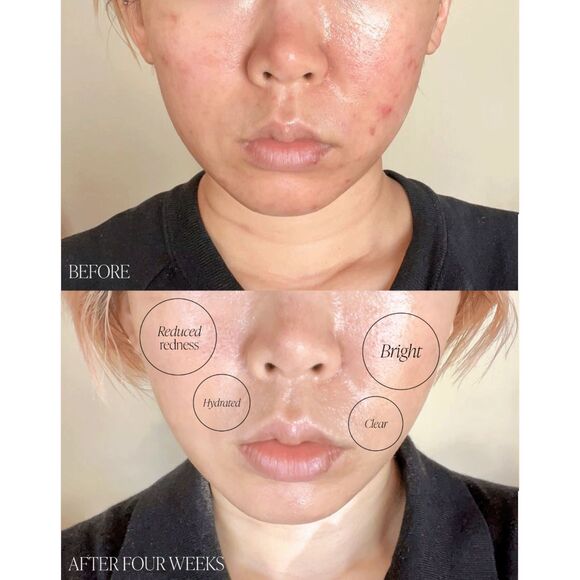 NIB Byroe Basil Dark Spot Correcting Cream Moisturizer - Picture 4 of 11